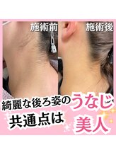 ホワイトワックス 名古屋金山店(WHITE WAX)/うなじ