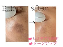 ムーン(moon)の雰囲気（施術後から効果を実感【当店人気No.1】シミ改善W照射定評あり◎）
