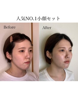 ナビレラ(navillera)の写真/【小顔矯正×アイブロウ】お顔のバランスを整えナチュラルに垢抜け♪小顔のプロがオーダーメイドでご提案◎