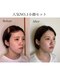 ナビレラ(navillera)の写真/【小顔矯正×アイブロウ】お顔のバランスを整えナチュラルに垢抜け♪小顔のプロがオーダーメイドでご提案◎