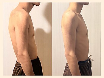 ラフリー 西宮北口院(RUFFREE)/猫背を根本改善【西宮北口院】