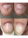 お客様Before after