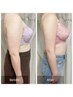 【二の腕の脂肪を胸に移動！】育乳＋二の腕揉み＋豊胸マシーン★¥9,900