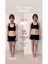 レシオボディデザイン 問屋町店(RETIO BODY DESIGN)/お客様の変化【20代後半 女性】