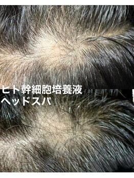 ミレマユメイク(mire)/血行促進・白髪対策ヘッドスパ