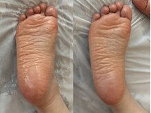 クリスタリオサーナエヌ 自由が丘(crystallo Sana N)/リンパマッサージは足裏から