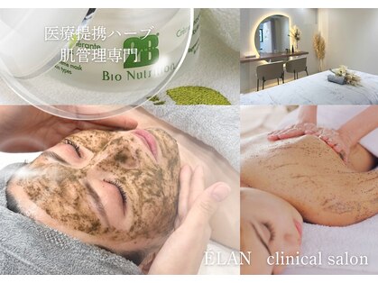 エラン(ELAN)の写真