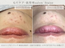 フレーズ(fraise)の雰囲気(白玉ハーブで揺らぎにくいお肌に♪)