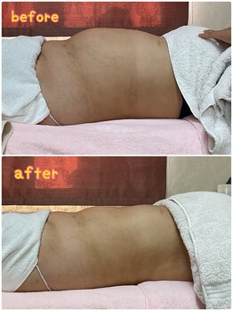 アンジュブリアン(Ange brillant)の写真/【赤岩式腸削りで身体の芯から整える】【インディバで燃やせる体へ◎】最強タッグのサイズダウン★
