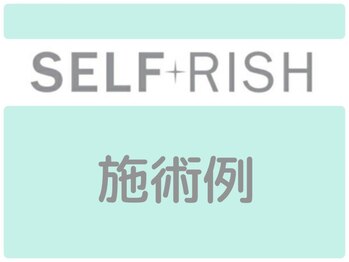 セルフリッシュ 町田店(SELFRISH)/当店でホワイトニングされた例↓