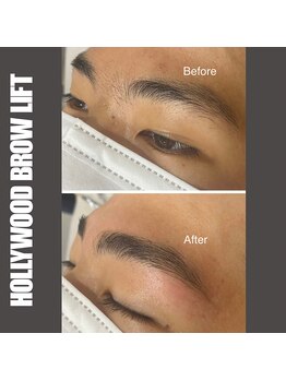 セラス(CERAS)/ハリウッドブロウリフト