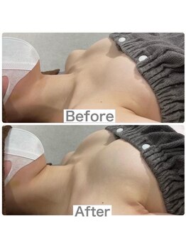 リリーパッソ(Lily passo)/施術内容