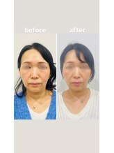 赤沼鍼灸整骨院/美・健康・笑顔に導く美容鍼