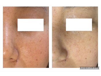 オアジスパ(Oasi Spa)/