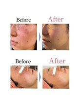 銀座ナチュラルスタイル/フェイシャル/毛穴/整体