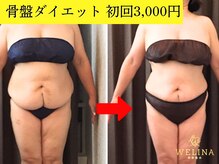 美容整体 ウェリナ 蟹江院