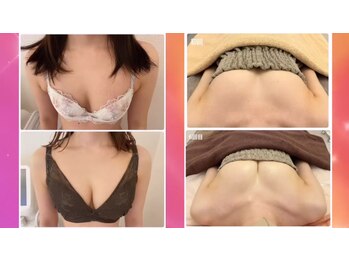 スマイルクルー(SmileClue)/ビフォーアフター症例