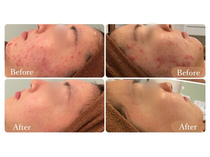 ビオエル 横浜店(Bioel)の写真