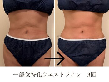 シーズ/ビフォーアフターその１