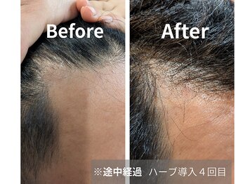 アリー(Alii)/グリーンピールヘアブースト