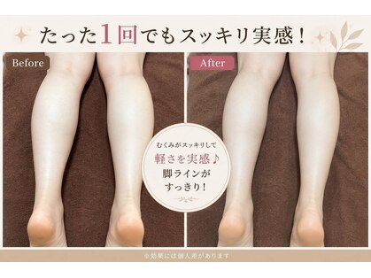 クロレ(Colorer)の写真