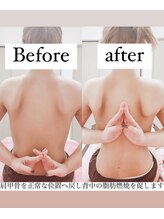 フェミニー(Feminy)/【痩身】背中ケア