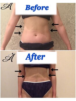 セレスティアル ビューティ アデ 岐阜南店(Celestial Beauty ADE)/ビフォーアフター☆