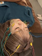 サボテン/ダウンタイムなし