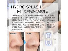 ラキネイ 目黒(Lakinei)の雰囲気（お肌の弱い方でも刺激なく受けていただける水素水の毛穴洗浄◎）