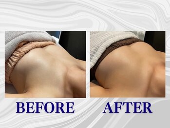 ザモア 福岡天神(THE MORE)/【症例 Before After】