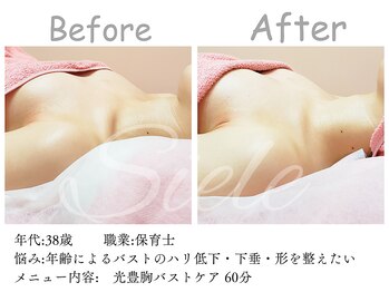 シエル(Siele)/左右差、離れ乳はまずは全身ケア