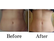 ヨサパーク ユユ(YOSA PARK yuyu)/痩身