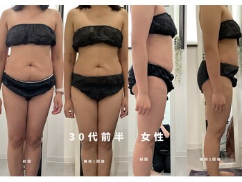 ウルト アルティメイトスキン(ULT ultimate skin)/くびれ作りたいなら♪