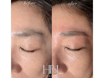 シエル(ciel)/ビフォー→アフター