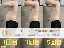 ペリー(PELLY)/男性20代　before after