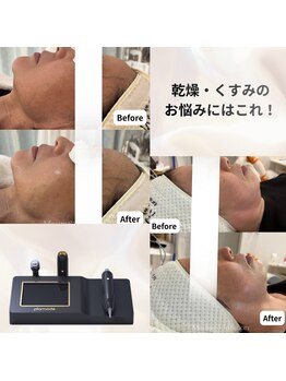 マウム(Maum)の写真/【韓国で大定番高密度超音波】マウム式ツヤ肌リフティングで憧れの水光肌へ☆細胞活性化＆土台ケア！