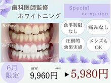ホワイトニングカフェ 上田店(WhiteningCafe)