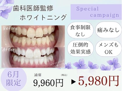 ホワイトニングカフェ 上田店(WhiteningCafe)の写真