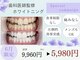 ホワイトニングカフェ 上田店(WhiteningCafe)の写真