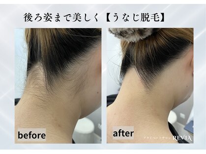 レビア(REVIA)の写真