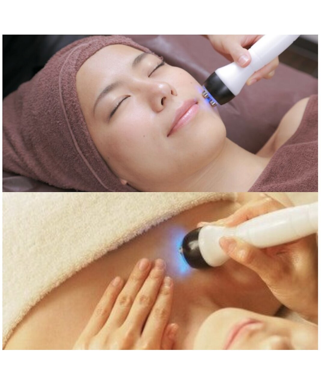 【4週間以内】ハイパーナイフ フェイシャル 60分\5,800