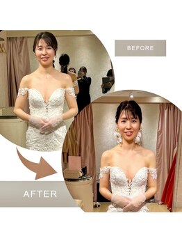 整骨院鍼灸院アシスト/花嫁美容におすすめ♪