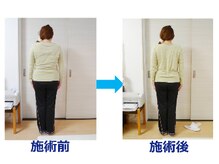 銀座スッキリ整体サロン/整体＋姿勢矯正で後ろ姿が別人！