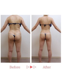 エルクレスト 新宿店/全身のサイズダウン