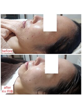 ミュー(Mieux)/肌が強くなっていく化粧品を実感