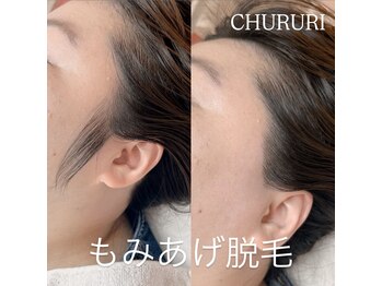 チュルリ 新町店(Chururi)/もみあげワックス脱毛