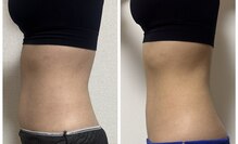 バイオ スキン プラス(Bio Skin Plus)