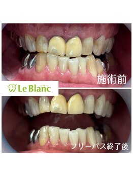ルブラン 奈良店(Le Blanc)/白い歯で印象UP！