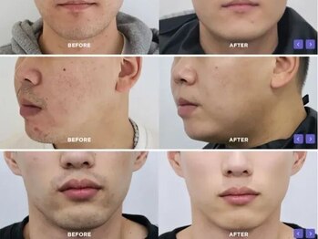 アール(R)の写真/清潔感UP★気になるムダ毛をケアし、周囲に好印象を与えるツルスベ肌へ！プロの技術で目指す美肌習慣♪