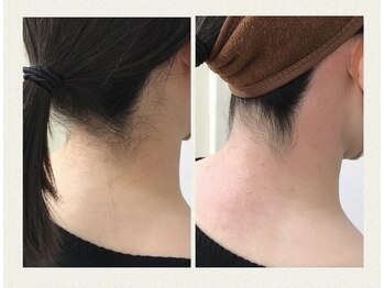 アイラッシュ フロウ(eyelash Flow)の写真/☆うなじ美人☆うなじWaxで清潔感アップ♪夏に向けてオススメ♪完全個室でプライバシーも◎四街道駅徒歩1分